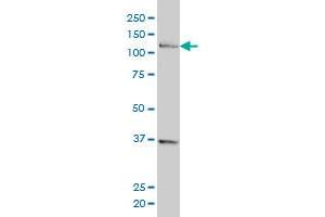 CHTF18 monoclonal antibody (M01), clone 1F5 Western Blot analysis of CHTF18 expression in HeLa .