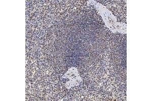 IHC analysis of U1A/SNRPA using anti-U1A/SNRPA antibody (ABIN7600891). (SNRPA1 anticorps  (AA 25-218))