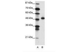 Image no. 1 for anti-Mesenchyme Homeobox 2 (MEOX2) (C-Term) antibody (ABIN202201) (MEOX2 anticorps  (C-Term))