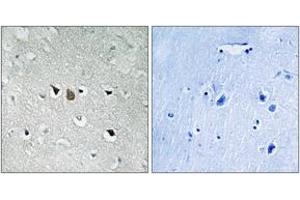 Immunohistochemistry analysis of paraffin-embedded human brain tissue, using C-RAF (Ab-269) Antibody. (RAF1 anticorps  (AA 231-280))