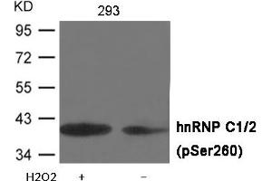 Western blot analysis of extracts from 293 cells untreated or treated with H2O2 using hnRNP C1/2 (Phospho-Ser260) Antibody . (HNRNPC anticorps  (pSer260))