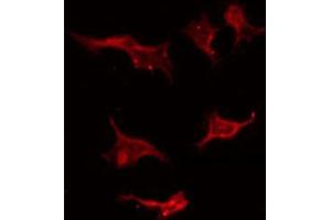 ABIN6267405 staining Hela by IF/ICC. (Stathmin 1 anticorps  (pSer25))