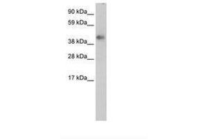 Image no. 1 for anti-Zinc Finger Protein 620 (ZNF620) (AA 324-373) antibody (ABIN202486) (ZNF620 anticorps  (AA 324-373))