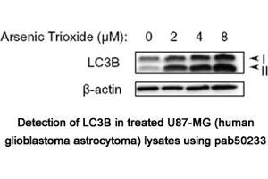 Image no. 1 for anti-Microtubule-Associated Protein 1 Light Chain 3 beta (MAP1LC3B) (N-Term) antibody (ABIN363542)