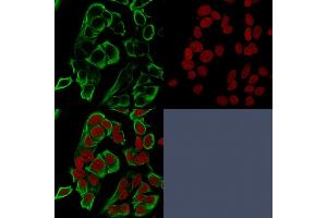 Confocal immunofluorescence analysis of MCF-7 cells using EpCAM Mouse Recombinant Monoclonal Antibody (rMOC-31) labeled in Green. (Recombinant EpCAM anticorps)