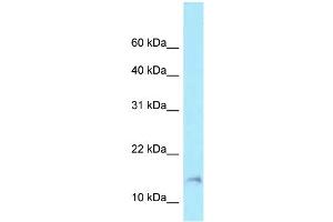 WB Suggested Anti-BAD Antibody Titration: 1. (BAD anticorps  (Middle Region))