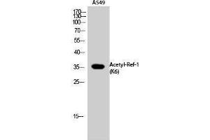 Western Blotting (WB) image for anti-Apurinic/Apyrimidinic Endonuclease 1 (APEX1) (acLys6) antibody (ABIN3181880) (APEX1 anticorps  (acLys6))