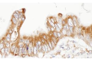 Immunohistochemistry (IHC) image for anti-Protein Disulfide Isomerase Family A, Member 6 (PDIA6) (AA 390-440) antibody (ABIN7453917) (PDIA6 anticorps  (AA 390-440))