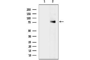 anti-Zinc Finger and BTB Domain Containing 20 (ZBTB20) antibody