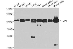 Western blot analysis of extracts of various cell lines, using TOP1 antibody. (Topoisomerase I anticorps)