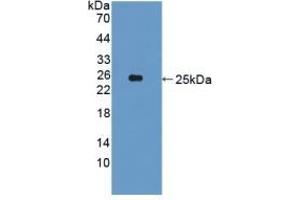 Detection of Recombinant CDCP1, Human using Polyclonal Antibody to CUB Domain Containing Protein 1 (CDCP1) (CDCP1 anticorps  (AA 689-836))