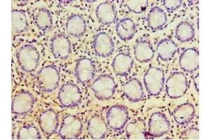 Immunohistochemistry of paraffin-embedded human colon tissue using ABIN7168119 at dilution of 1:100 (POP7 anticorps  (AA 1-140))