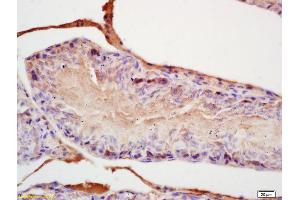 Formalin-fixed and paraffin embedded rat testis labeled with Rabbit Anti FGF8/HBGF-8 Polyclonal Antibody, Unconjugated (ABIN672516) at 1:200 followed by conjugation to the secondary antibody and DAB staining