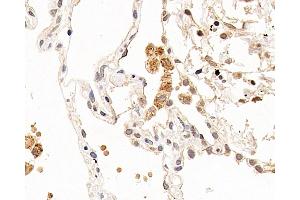 Immunohistochemistry analysis of paraffin-embedded human lung using CXCR7 Polyclonal Antibody at dilution of 1:100. (CXCR7 anticorps)