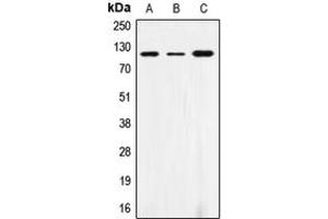 Western blot analysis of CD172a expression in THP1 (A), AML193 (B), HL60 (C) whole cell lysates. (SIRPA anticorps  (C-Term))