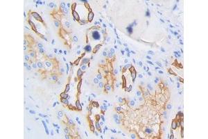 IHC-P analysis of kidney tissue, with DAB staining. (SPTLC3 anticorps  (AA 238-552))