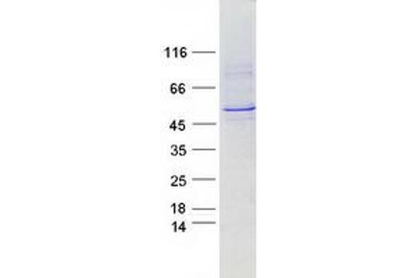 CYP2A6 Protein (Myc-DYKDDDDK Tag)
