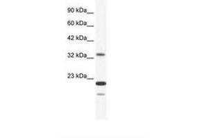 Image no. 1 for anti-Zinc Finger Protein 688 (ZNF688) (AA 95-144) antibody (ABIN203041) (ZNF688 anticorps  (AA 95-144))