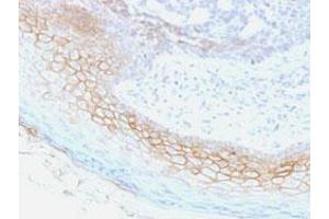 Immunohistochemical staining (Formalin-fixed paraffin-embedded sections) of human skin with DSC2/DSC3 monoclonal antibody, clone 7G6 . (Desmocollin 2 anticorps  (Extracellular Domain))