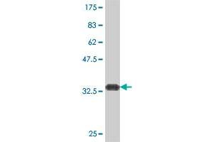 Western Blot detection against Immunogen (35. (HRASLS anticorps  (AA 55-138))