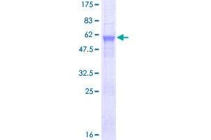 Image no. 1 for Alcohol Dehydrogenase 6 (Class V) (ADH6) (AA 1-295) protein (GST tag) (ABIN1305991)
