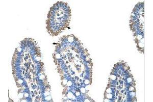 Image no. 1 for anti-Solute Carrier Family 22 (Organic Cation Transporter), Member 1 (SLC22A1) (AA 100-149) antibody (ABIN203396)