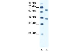 WB Suggested Anti-RRN3 Antibody Titration:  1. (RRN3 anticorps  (Middle Region))
