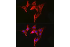 Immunofluorescence analysis of NIH-3T3 cells using α-Tubulin Mouse mAb (ABIN7271035) at dilution of 1:100 (40x lens). (TUBA4A anticorps)