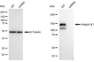 Western blotting analysis using Integrin beta 1 antibody (ABIN7799066).