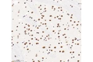 Immunohistochemistry analysis of paraffin-embedded mouse brain using,SNRPD2 (ABIN7075634) at dilution of 1: 1600 (SNRPD2 anticorps)