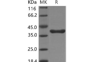 Western Blotting (WB) image for Arginase, Liver (ARG1) protein (MYC tag,His tag) (ABIN7317033)