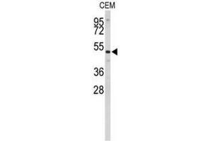Western blot analysis of CNDP1 Antibody (C-term) in CEM cell line lysates (35µg/lane).