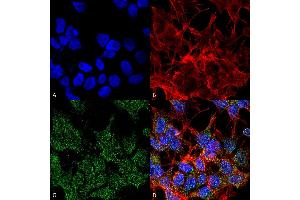 Immunocytochemistry/Immunofluorescence analysis using Mouse Anti-VGLUT2 Monoclonal Antibody, Clone S29-29 . (Solute Carrier Family 17 (Vesicular Glutamate Transporter), Member 6 (SLC17A6) (AA 501-582) anticorps (Atto 488))