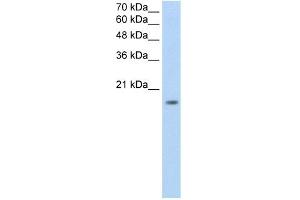WB Suggested Anti-ZNF580 Antibody Titration:  0. (ZNF580 anticorps  (N-Term))