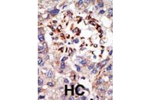 Immunohistochemistry (IHC) image for anti-Chromobox Homolog 8 (CBX8) antibody (ABIN3001538) (CBX8 anticorps)