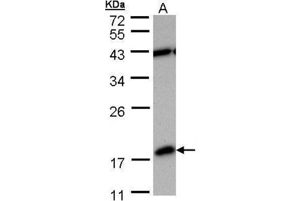 PDE6D anticorps  (full length)