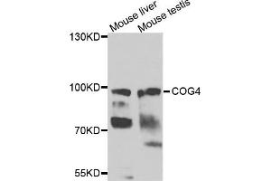 Western blot analysis of extracts of mouse liver and mouse testis cells, using COG4 antibody. (COG4 anticorps)