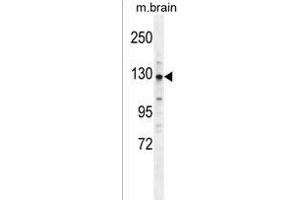 CYLN2 Antibody (C-term) (ABIN1537648 and ABIN2849319) western blot analysis in mouse brain tissue lysates (35 μg/lane). (CLIP2 anticorps  (C-Term))
