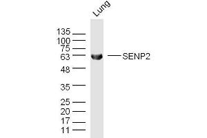 Mouse lung lysates probed with SENP2 Polyclonal Antibody, unconjugated  at 1:300 overnight at 4°C followed by a conjugated secondary antibody for 60 minutes at 37°C.