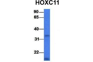 Host:  Rabbit  Target Name:  HOXC11  Sample Type:  721_B  Antibody Dilution:  1. (HOXC11 anticorps  (Middle Region))