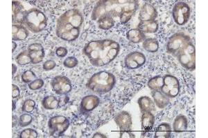 Image no. 2 for anti-Oxidative-Stress Responsive 1 (OXSR1) (AA 1-528) antibody (ABIN599107) (OXSR1 anticorps  (AA 1-528))