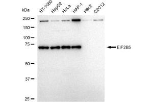 Western blotting analysis using EIF2B5 antibody (ABIN7798515).