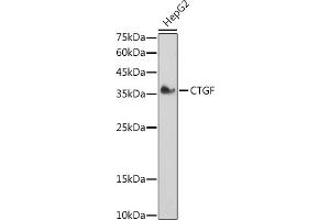 Western blot analysis of extracts of HepG2 cells, using CTGF antibody (ABIN6127716, ABIN6139187, ABIN6139190 and ABIN6215053) at 1:1000 dilution. (CTGF anticorps  (AA 27-349))