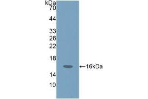 Detection of Recombinant ProGRP, Human using Polyclonal Antibody to Pro-Gastrin Releasing Peptide (ProGRP) (ProGRP anticorps  (AA 54-148))