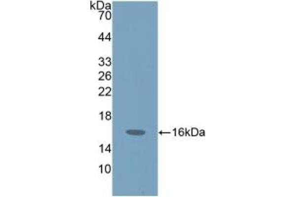 ProGRP antibody  (AA 54-148)