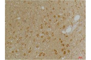 Immunohistochemistry (IHC) analysis of paraffin-embedded Rat Brain Tissue using GABA A Receptor alpha3 Rabbit Polyclonal Antibody diluted at 1:200.