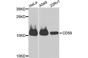 Western blot analysis of extracts of various cell lines, using CD59 antibody. (CD59 anticorps)