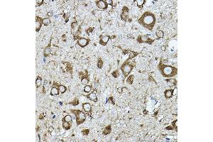 Immunohistochemistry of paraffin-embedded mouse spinal cord using KI Rabbit pAb (ABIN7271349) at dilution of 1:100 (40x lens).