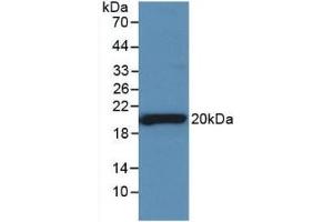 Detection of Recombinant SHBG, Rat using Monoclonal Antibody to Sex Hormone Binding Globulin (SHBG) (SHBG anticorps  (AA 222-358))