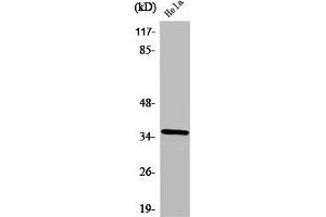 Western Blot analysis of HeLa cells using ZIS Polyclonal Antibody (ZNF265 anticorps  (Internal Region))